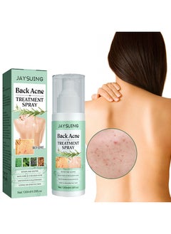 Back Acne Treatment Spray , Lighten Acne Marks Repair Back Shoulder Acne Skin,2% Salicylic Acid and Tea Tree Oil Spray 120ml