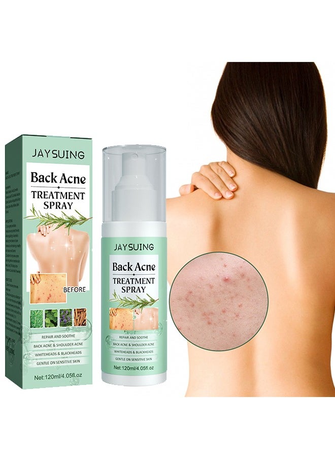 Jaysuing - Back Acne Treatment Spray , Lighten Acne Marks Repair Back Shoulder Acne Skin,2% Salicylic Acid and Tea Tree Oil Spray 120ml - Image 1
