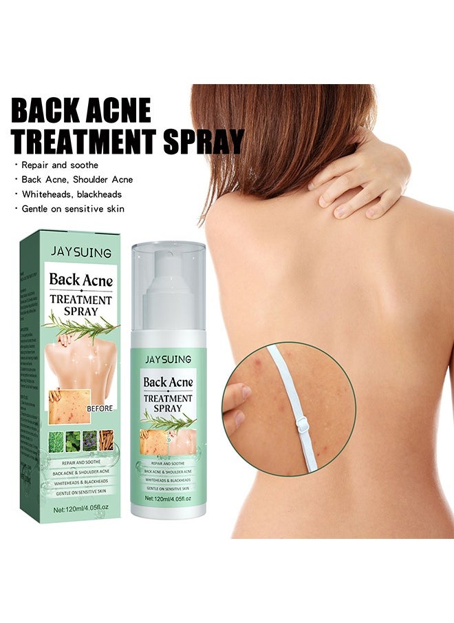 Jaysuing - Back Acne Treatment Spray , Lighten Acne Marks Repair Back Shoulder Acne Skin,2% Salicylic Acid and Tea Tree Oil Spray 120ml - Image 1