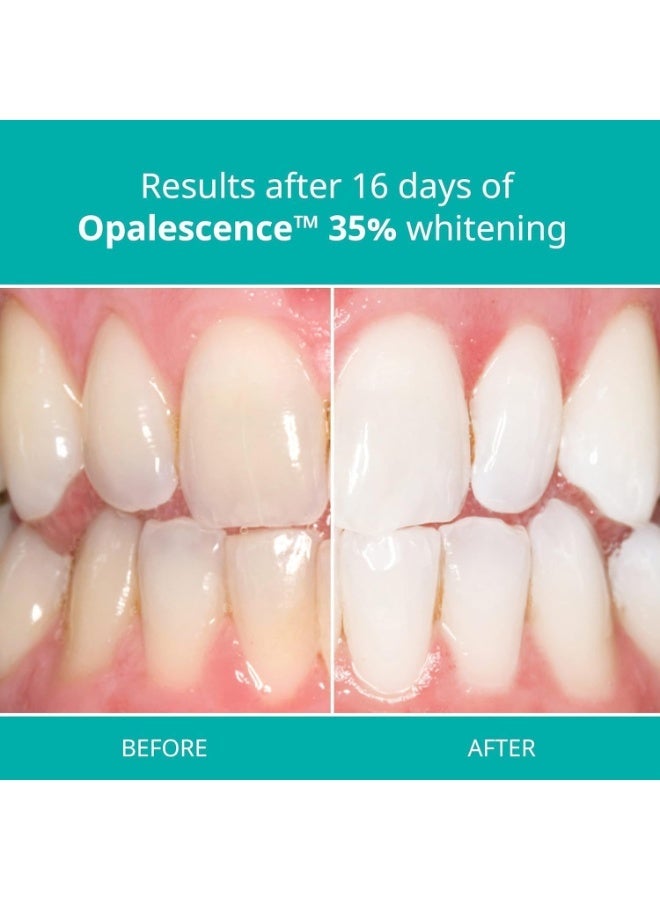 Opalescence 35% At-Home Teeth Whitening Gel Syringes (4 Pack) | Professional Whitening Kit with Carbamide Peroxide, Mint Flavor | Brighten Teeth Safely at Home - Image 2