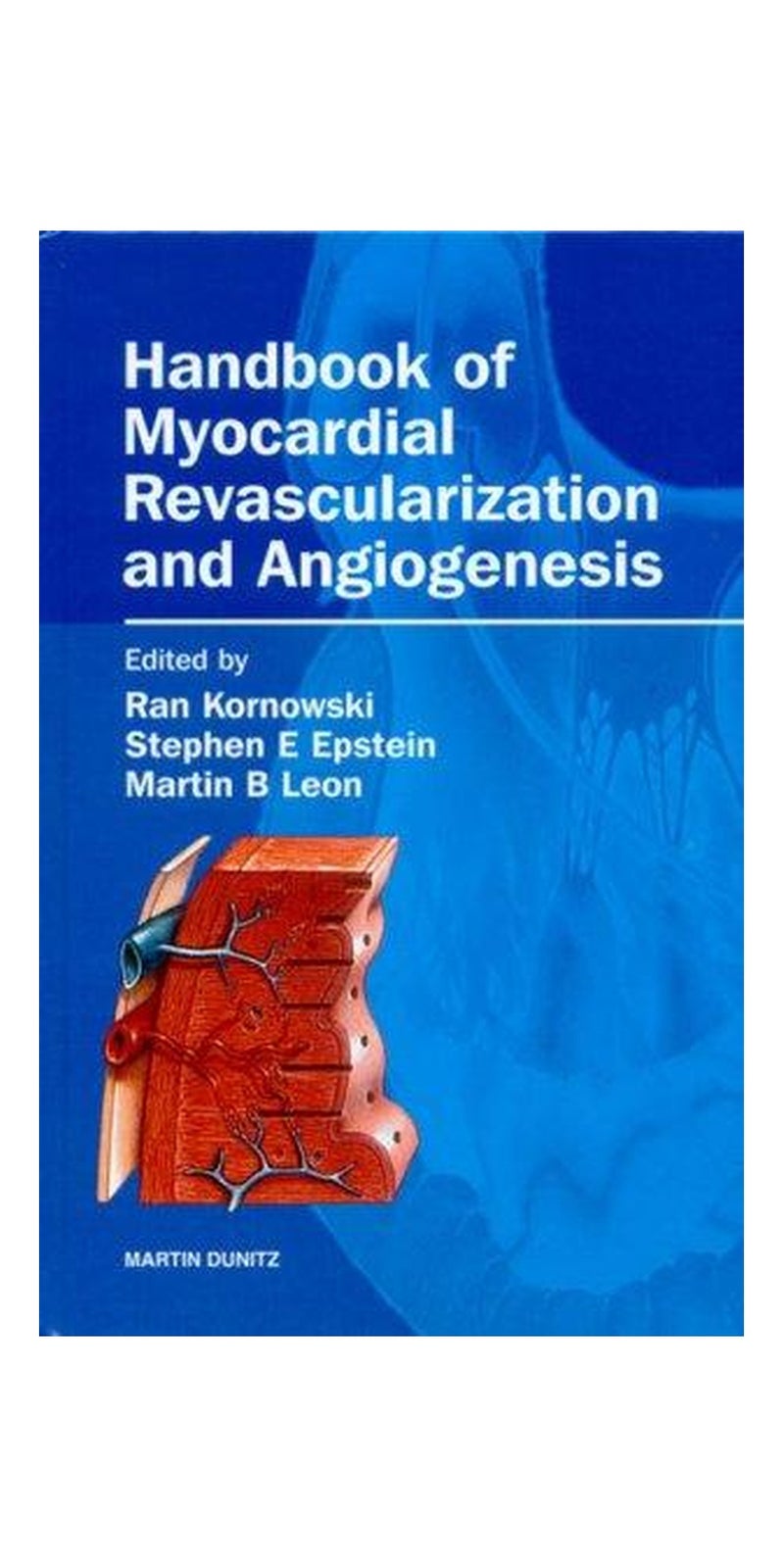 Handbook of Myocardial Revascularization and Angiogenesis | Authored by Martin B Leon, Ran Kornowski, Stephen E Epstein | Hardcover | Published by Informa Healthcare