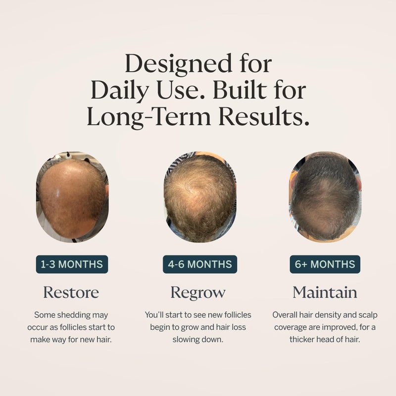 Happy Head Hair Regrowth Serum â€“ Leave-In Scalp & Hair Treatment with ProcapilÂ®, Biotin & Rosemary â€“ Lightweight Formula â€“ 2oz - Image 5
