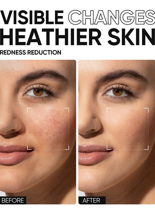 SKINTIFIC 5X Ceramides Moisture Barrier Cream, Hydrating Skin Barrier Repair Face Moisturizer for All Skin Types with Hyaluronic Acid & Centella, Daily Moisturizer, Non-Comedogenic - Image 4