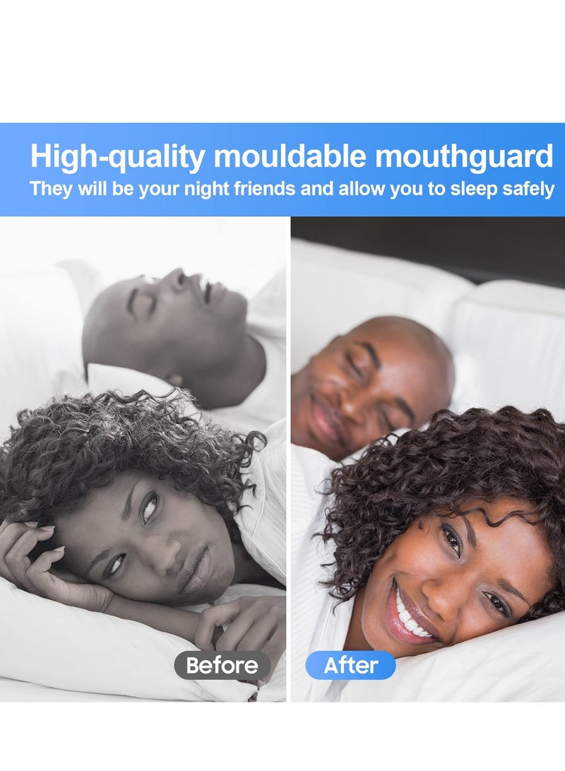 VIUAUAX Mouth Guard for Grinding Teeth, 4 Pcs Mouth Guard for Sleeping at Night, Reusable Mouth Guards for Clenching Teeth at Night  - Image 3