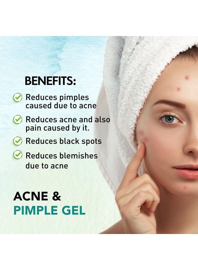 MITVANA Acne & Pimple Gel 30G With Neem & Turmeric X 2 - Image 5