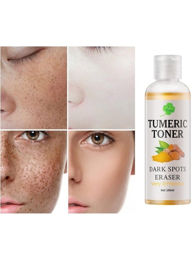 Tumeric Toner Dark Spots Eraser Correcting Toner, Facial Toner for Acne Prone Skin, Blemish Removing Facial Moisturizer for Women, Dry Oily Skin Hypermentation Treatment, 100ml