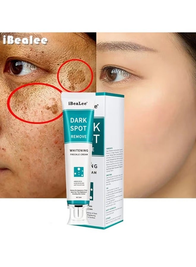 iBealee Dark Spot Remover for Face Peeling Skin Whitening Freckle Cream Pigmentation Treatment Sun Spots Age Spots Blemish Remover Lightening Cream - Image 1