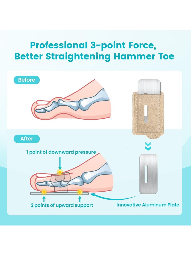 LAIAOCISI 8-Pack Bunion Corrector Pad Toe Separators Wraps, Toe Splint Brace Cover, Toe Corrector with Padding Support Protector Cover - Image 3