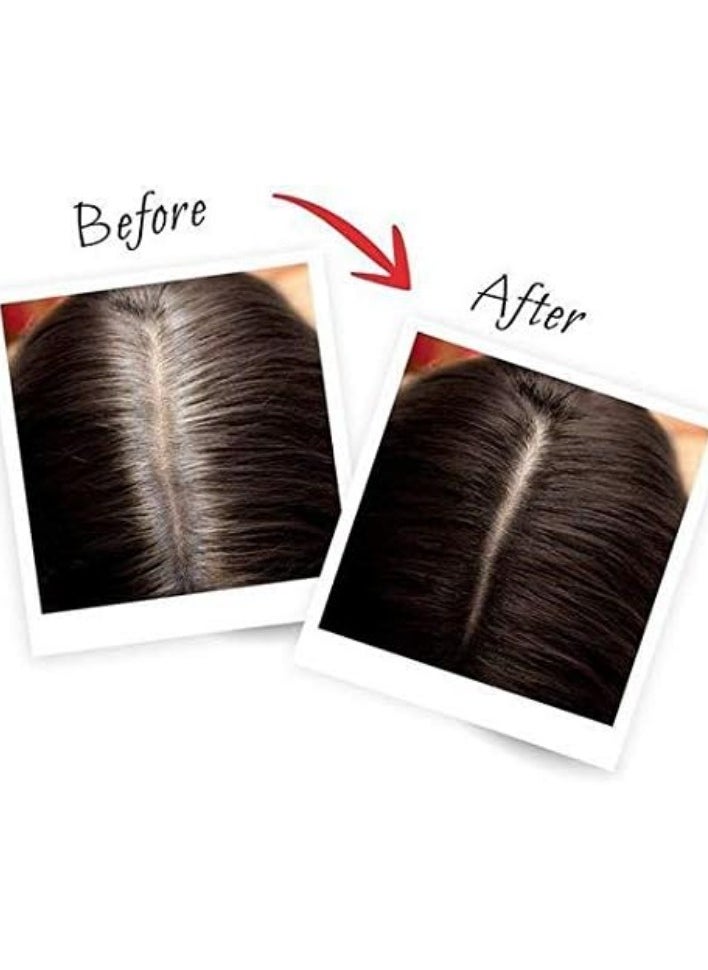 L'OREAL PARIS - Loreal Paris Magic Retouch Instant Root Concealer Dark Brown 75 Ml - Image 1