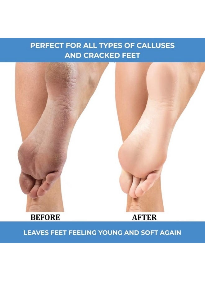 ForPro Professional Collection Advanced Callus Eliminator Gel Professional Grade No Drip Callus Remover Gel For Feet 8 Oz.  - Image 3