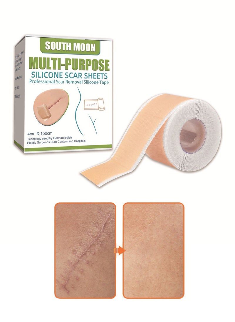 SOUTH MOON Multi-Purpose Silicone Scar Sheets, Efficient Beauty Scars Removal for C-Section, Surgery, Burn, Acne 4*1.5m  - Image 1