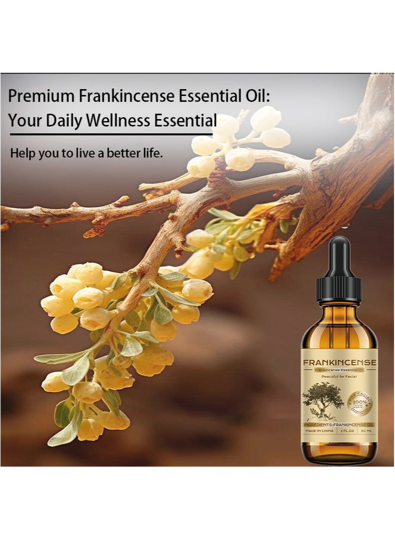 wachinas 100% Natural Frankincense Resin Oil with Dropper - Soothes Irritated Skin,Deep Hydration for All Skin Types,Ideal for Daily Skincare Routine,For Diffuser,Hair Care,Facial Care,Skin Care,Aromatherapy, Scalp and Body Massage,Soap and Candle Making,1 Fl Oz - Image 4
