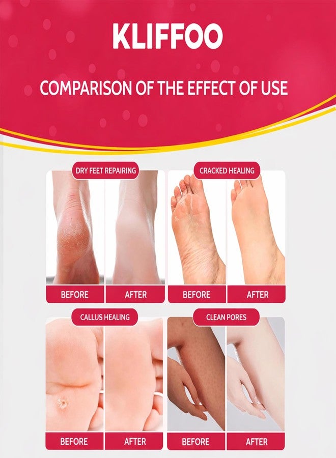 KLIFFOO Herbal Detox Foot Soak for Men and Women - Image 4