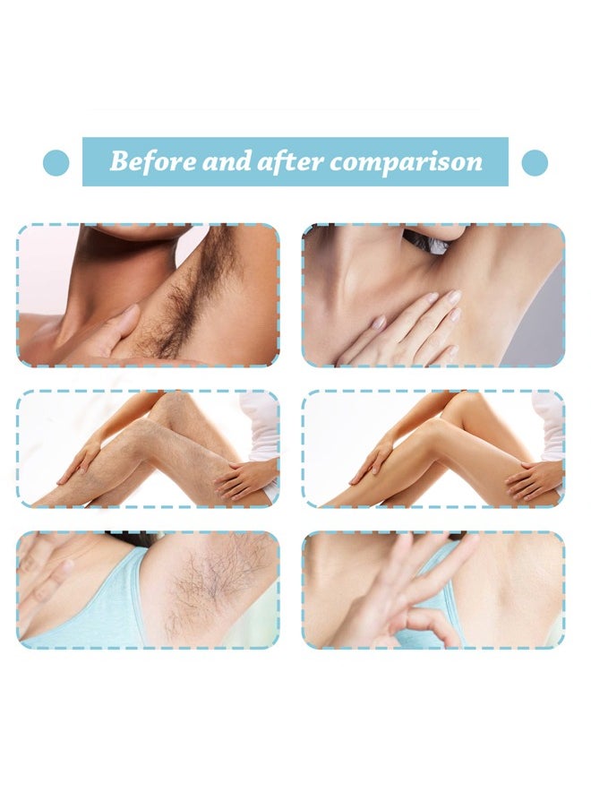West&Month - Hair Removal Spray, Painless Hair Removal Spray Armpit Gentle Hair Remover Refreshing Quick Hair Removal Spray, Safe Hair Removal for Underarm, Chest, Back, Leg and Private Part - Image 1