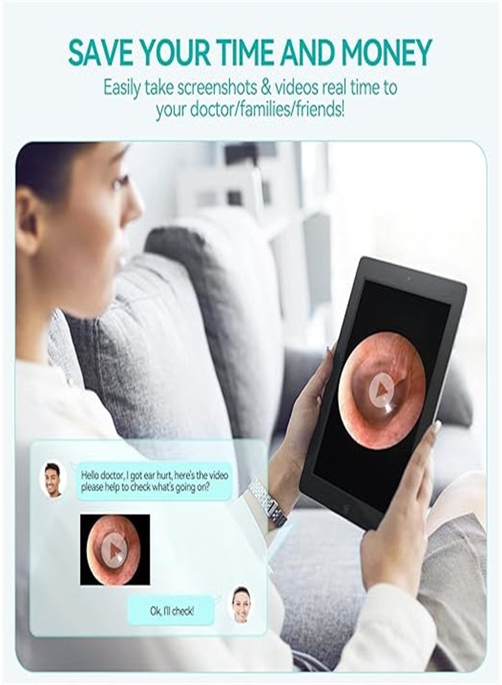 Wireless Otoscope Dual View Camera, 3.9mm 720PHD WiFi Otoscope with 6 LED Lights for Kids and Adults, Compatible with Android and iPhone - Image 4