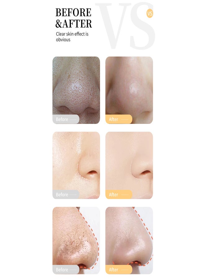 RtopR Blackhead Remover Mask Extract Anti Aging Cleansing Blackhead Masks Peel off Facial Mask Deep Cleansing Blackheads Removal Mask - Image 5