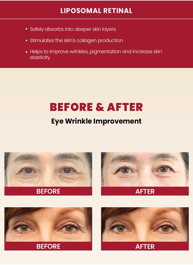 K-SECRET SEOUL 1988 Eye Cream: Powerful Retinal Liposome 4% & Fermented Bean for Smooth, Youthful Skin(Packaging May Vary)  - Image 5