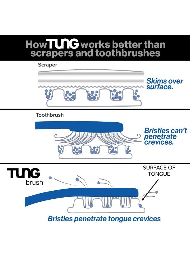 Tung Tongue Cleaning Kit, Tung Brush and Gel, Bad Breath Odor Eliminator, Halitosis Defense, USA Made (Set of 1) - Image 4