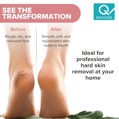 Q DEVICES Electric Foot Callus Remover – Rechargeable Pedicure Tool with 2 Grinding Heads, Waterproof & Travel-Friendly Design for Smooth, Soft Feet - Image 4