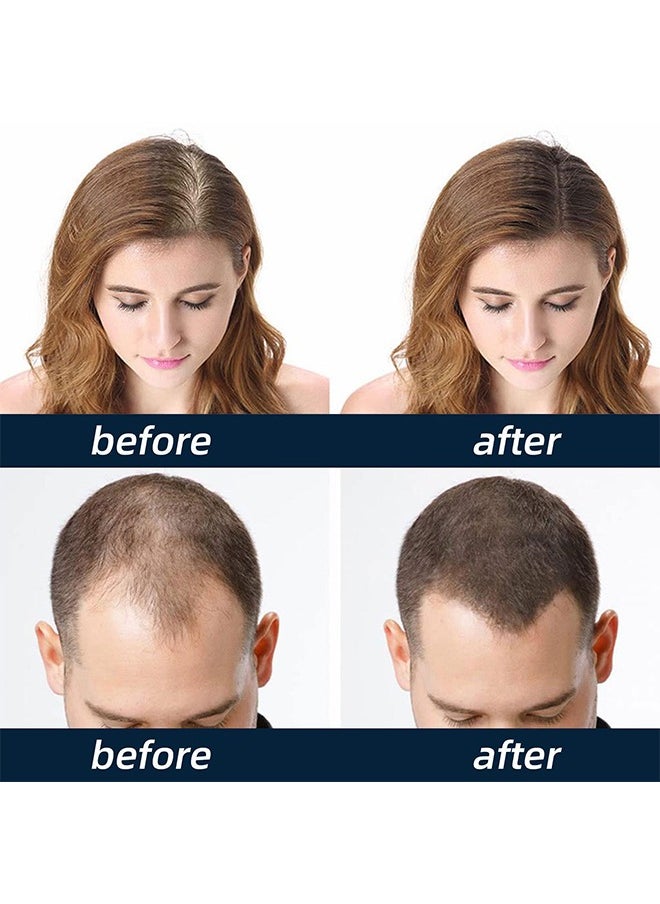 East Moon - East moon Men's Hair Growth Spray Hairline Thickening Hair Thickness Hair Loss Treatment Women - Image 1