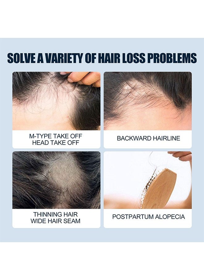 East Moon - East moon Men's Hair Growth Spray Hairline Thickening Hair Thickness Hair Loss Treatment Women - Image 1