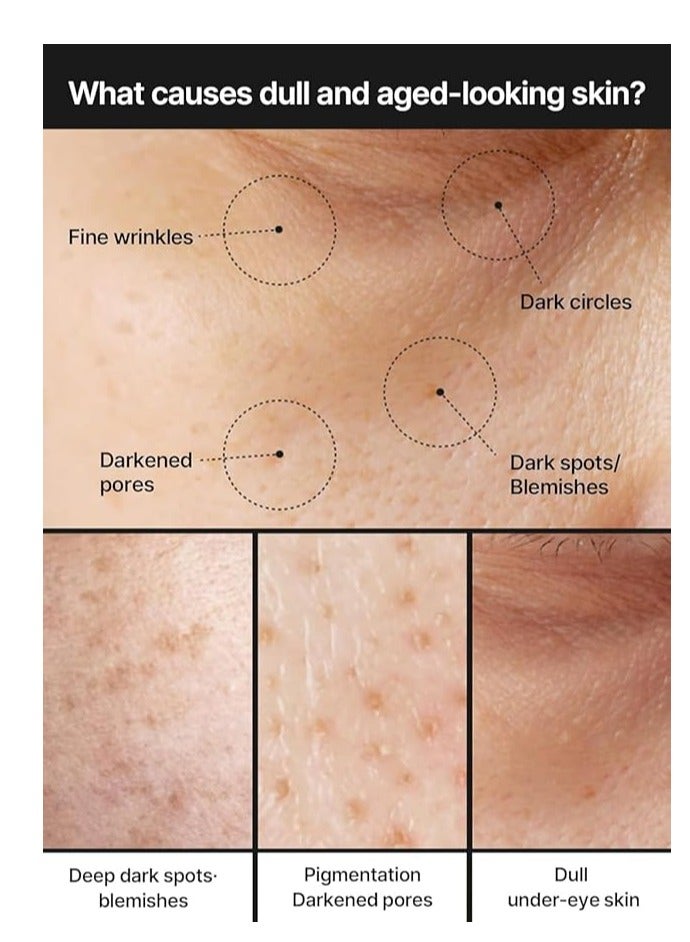 celimax Pore+Dark Spot Brightening Cream | with Niacinamide, Tranexamic Acid, TXA Cream, Pore Minimizer, Non-Irritating, Hydrating, For Sensitive Skin, 35ml - Image 3