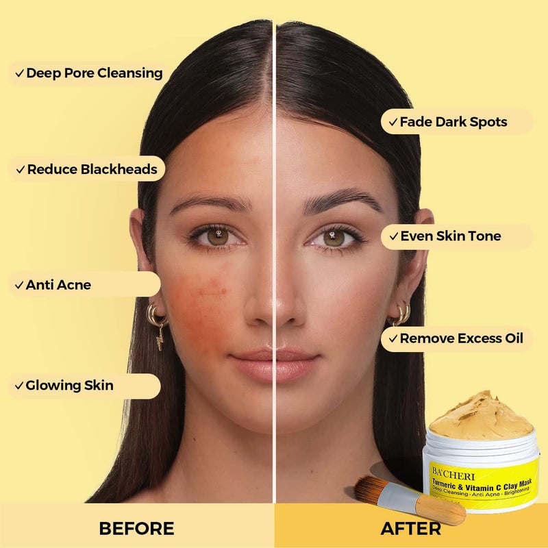 BACHERI Turmeric Vitamin C Clay Mask # 130g, Blackheads Acne Dark Spots Remover with Turmeric Extract, Glowing Skin, Refining Pores and Controlling Oil - Image 4