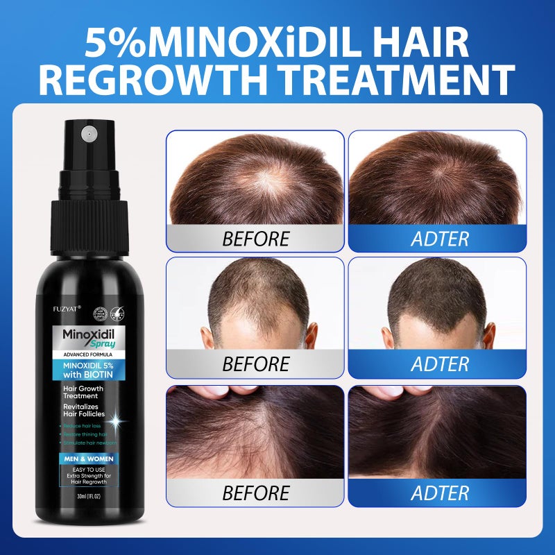 FUZYAT 5% Minoxidil for Men Hair Loss Treatment, Minoxidil for Women Hair Growth Spray, For Men & Women, Supports Thinning Hair, With Biotin, Easy Daily Application (60ml) - Image 3