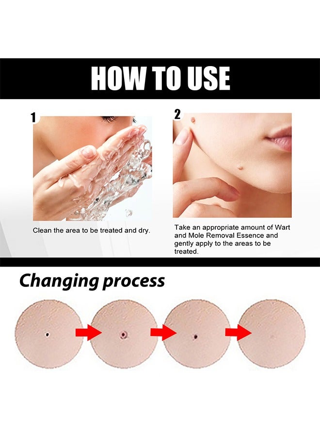 EELHOE Aclive Skin Mole Removal,Natural Skin Mole Remover Liquid 10ml  - Image 5