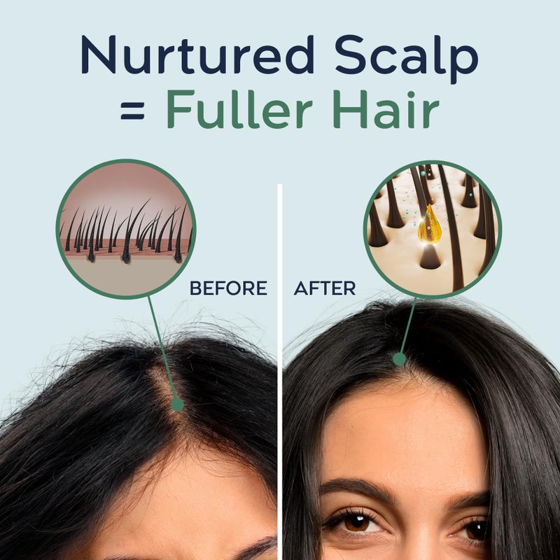 Tree To Tub Rosemary Water Spray for Hair Growth - Fermented Rice Water for Hair Growth Nature's Rosemary Hair Spray & Nourishing Scalp Care - Image 2