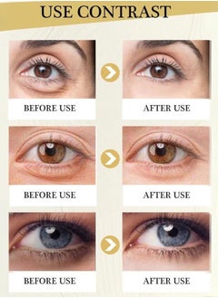 JoyPretty Polypeptide Multi Effects Eye Cream Reduce Puffiness Super Hydrating Moisturizing Peptide Eye Cream Anti Aging Anti Wrinkle Lightening Dark Circles Tightening Skin Eye Cream 20g  - Image 2