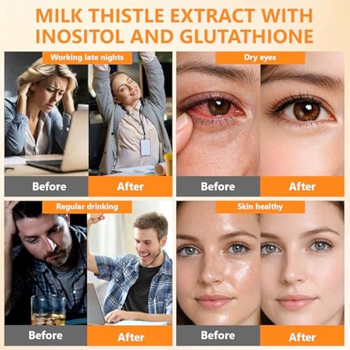 Liver Cleanse Detox for Women: Milk Thistle with Dandelion for Liver Support, Inositol & Glutathione for Antioxidant Metabolic Health Non-GMO 60 Capsules - Image 4