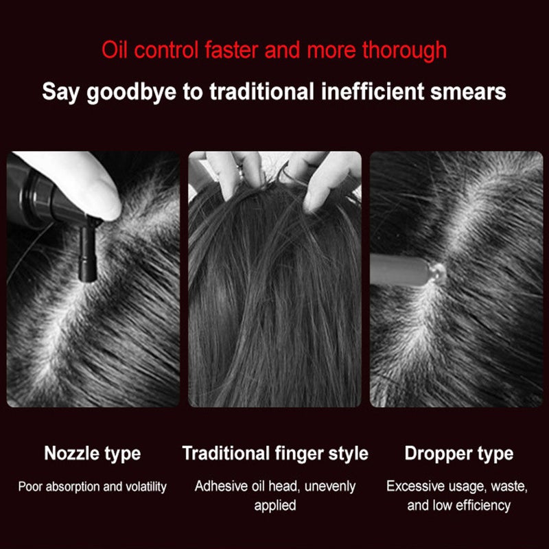 Premium Scalp Massaging Brush with Oil Applicator - Cordless Electric Massager for Scalp & Hair, Shiatsu Massage, IPX7 Waterproof, Portable Deep Massager For Hair & Head Relaxation at Home - Image 4