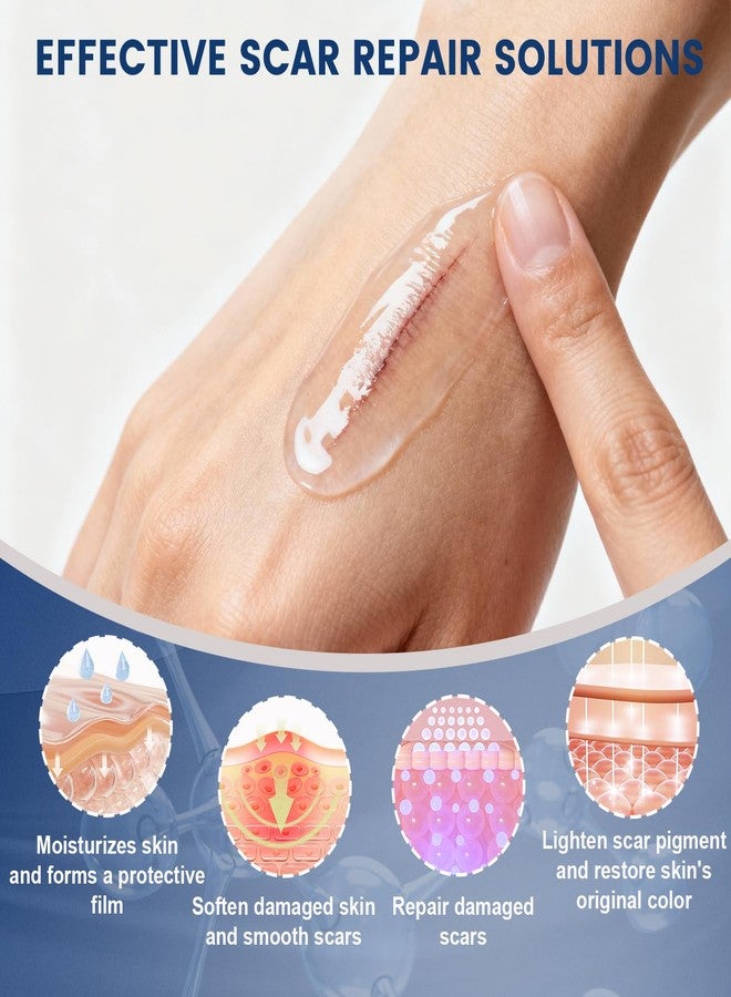 Rvlaim 100% Silicone Scar Gel Scar Cream, Advanced Silicone Gel for Removal of Surgical, Burns, Acne Scar, Old and Recent Scars and Stretch Marks, 1.7 oz/50ml - Image 5