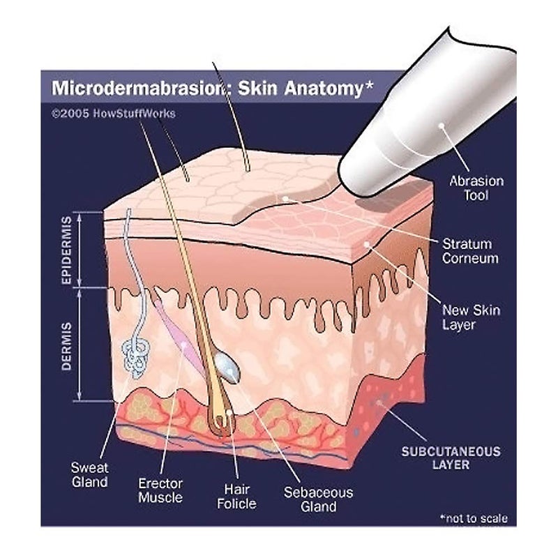 NeedCrystals بلورات نيد كريستالز للميكروديرمابراشن، علاج تقشير الوجه الطبيعي بالكامل للبشرة الباهتة أو الجافة، التجاعيد، العيوب، الندوب والمزيد (4 رطل، 120 حبيبة) - Image 2