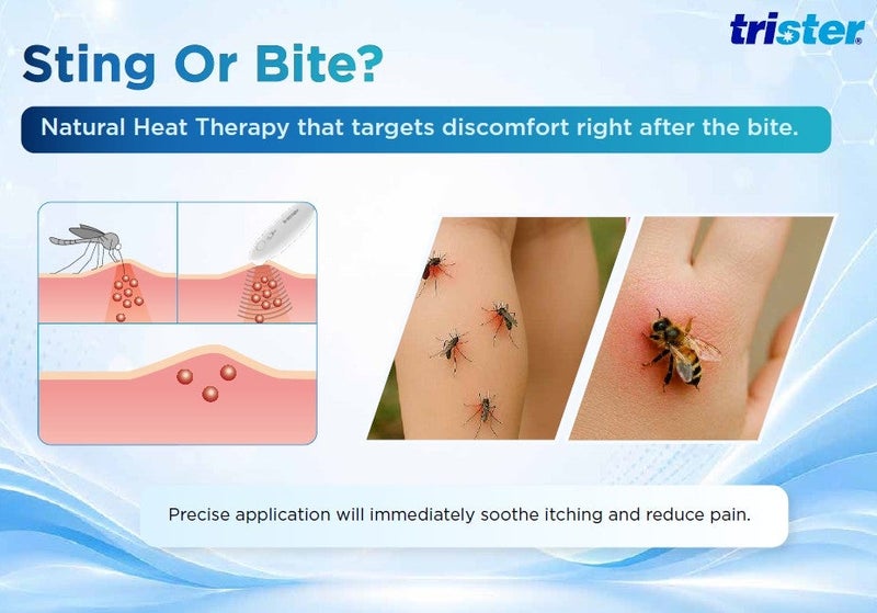 trister Insect Bite Healer (TS-549IBH) — Chemical-Free Heat Therapy for Mosquito, Bee & Wasp Bites — 5s & 10s Treatment, Portable, Battery Operated - Image 4