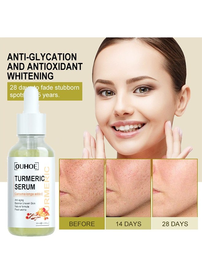 OUHOE - Turmeric Serum-Curcuma ​Dark Spot And Anti-Aging Turmeric Repair Face Serum, Natural Turmeric Bright Skin Dark Spot Skin Care Moisturizing Repair Serum Turmeric Oil For Face 30ml - Image 1