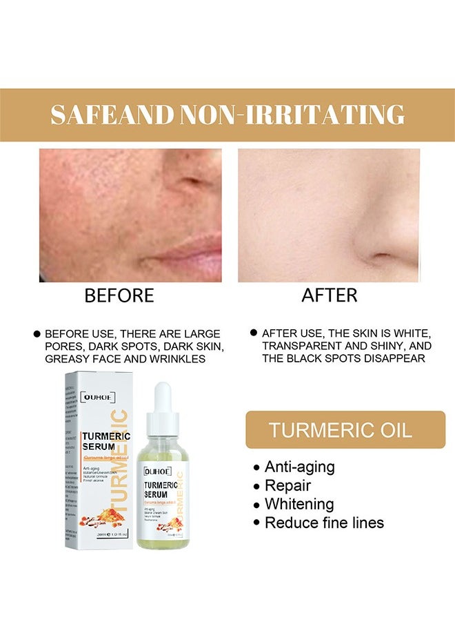 OUHOE - Turmeric Serum-Curcuma ​Dark Spot And Anti-Aging Turmeric Repair Face Serum, Natural Turmeric Bright Skin Dark Spot Skin Care Moisturizing Repair Serum Turmeric Oil For Face 30ml - Image 1