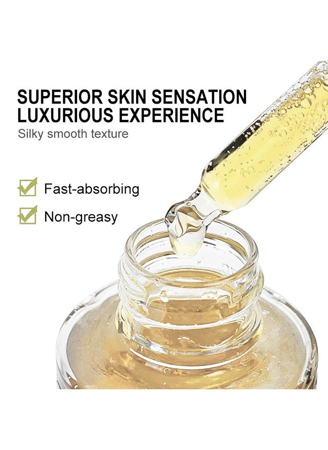 OUHOE - Turmeric Serum-Curcuma ​Dark Spot And Anti-Aging Turmeric Repair Face Serum, Natural Turmeric Bright Skin Dark Spot Skin Care Moisturizing Repair Serum Turmeric Oil For Face 30ml - Image 1