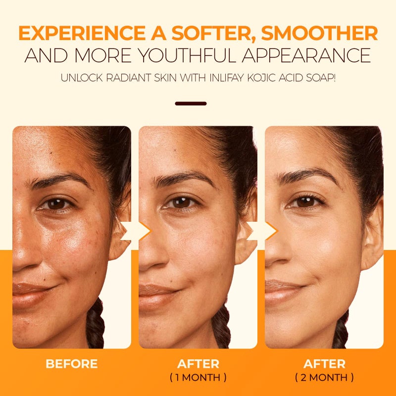 Inlifay Kojic Acid Turmeric Soap: Dark Spot Remover for Face Body - Skin Cleansing Bar for Women with Hyperpigmentation - Home Travel Use in Summer - Image 5