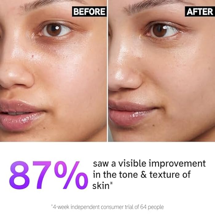 The INKEY List 15% Vitamin C and EGF Serum 1 Fl Oz, Reduces Hyperpigmentation, Rejuvenating Skin Care, Vegan Friendly, Suitable For All Skin Types - Image 2