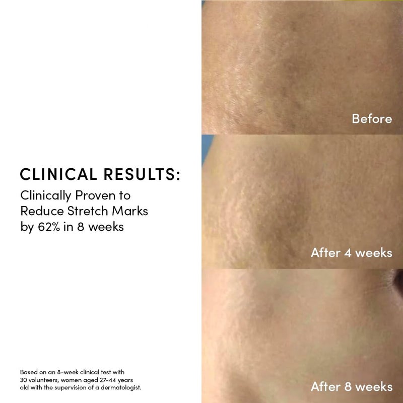 Evereden Golden Belly Serum, 1.7 fl oz. | Clean & Vegan Women's Belly Oil for Pregnancy and Postpartum | Clean Maternity Skincare | Non-Toxic Stretch Mark Oil - Image 4