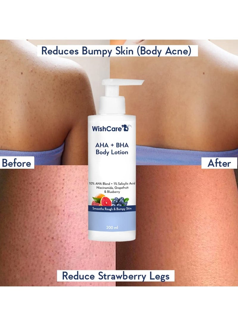 WishCare 10% AHA 1% BHA Body Lotion Smooths Rough Bumpy Skin Glycolic Lactic Acid Body Lotion with Niacinamide 200 Ml