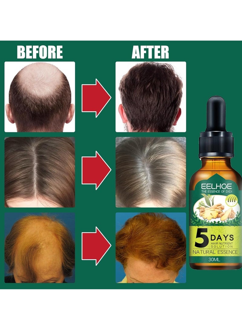 Eelhoe Ginger Hair Care Essential Oil Hair Growth Liquid Growth Liquid Anti-hair Loss Essential Oil Care Essence - Image 3