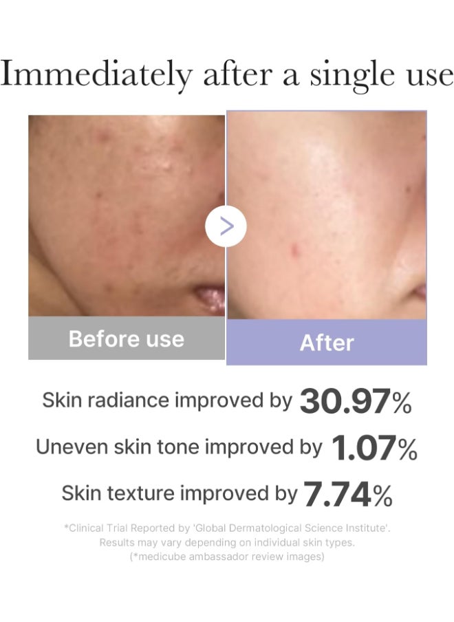 Medicube Mini Booster Pro Pink | Affordable At-Home Facial Skin Care Tool for Beginners - Portable Glow Booster for Glass Skin, Boosting Skin Care Absorption, Skin care for teens, Korean Skin Care  - Image 3