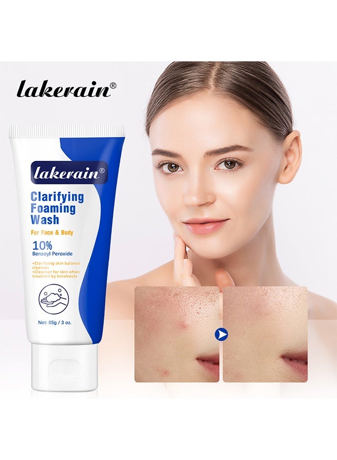 lakerain Clarifying Foaming Wash for Face & Body 85g - 10% Benzoyl Peroxide | Deep Cleansing & Oil Control | Acne & Blackhead Treatment,85g - Image 3