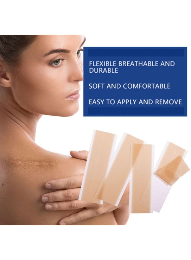 Monda Silicone Scar Tape, Medical Silicone Scar Removal Sheet, Treatment Waterproof Silicone Scar Sheet，painless Silicone Gel Strips，Fade Scar Effective for C-Section, Burn, Surgery & Acne Scars（4-pack） - Image 4