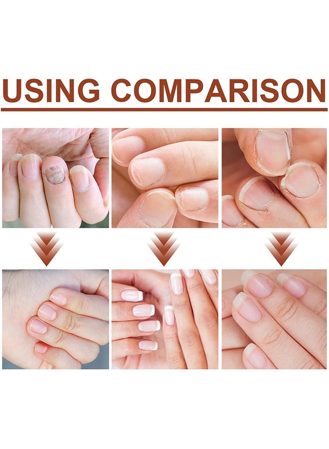 أيدول تقسية الأظافر، حل تغذية الأظافر لعلاج نمو الأظافر، تقوية الأظافر البولندية للأظافر الضعيفة والتالفة، مصل الأظافر للقوة والإصلاح، تقسية الأظافر لرعاية الأظافر، 15 مل - Image 3