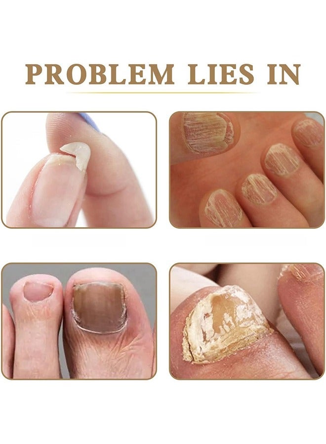 أيدول تقسية الأظافر، حل تغذية الأظافر لعلاج نمو الأظافر، تقوية الأظافر البولندية للأظافر الضعيفة والتالفة، مصل الأظافر للقوة والإصلاح، تقسية الأظافر لرعاية الأظافر، 15 مل - Image 4
