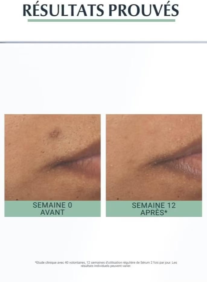 يوسيرين سيروم ديرموبيور ثلاثي المفعول - 40 مل - Image 4